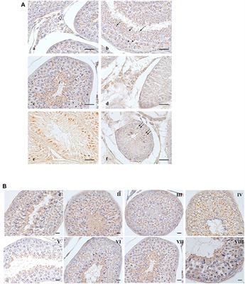 Does Orexin B-Binding Receptor 2 for Orexins Regulate Testicular and Epididymal Functions in Normal and Cryptorchid Dogs?